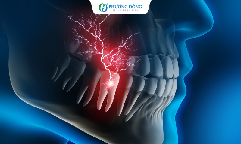 Đau răng số 6-7 sau khi nhổ răng số 8