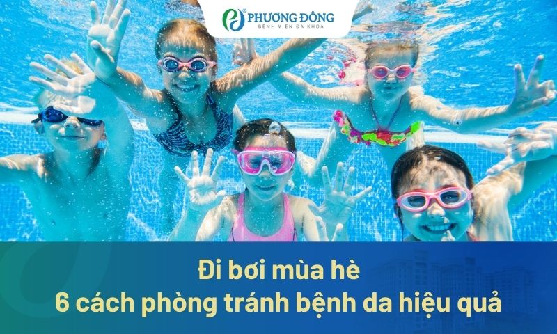 Đi bơi mùa hè: 6 cách phòng tránh bệnh da hiệu quả 