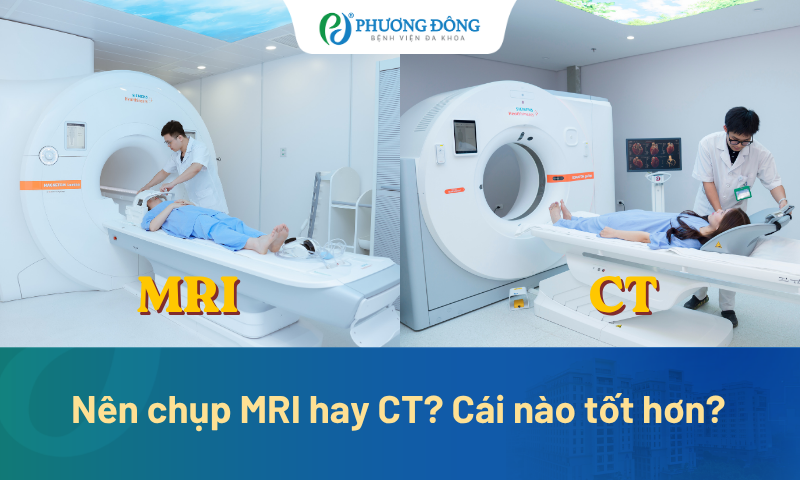 Nên chụp MRI hay CT để chẩn đoán bệnh? Cái nào tốt hơn?