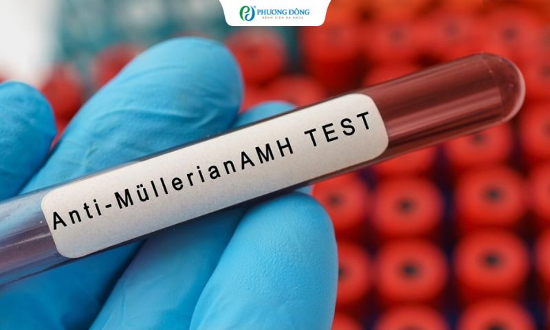 Hỏi đáp với bác sĩ: 35 tuổi, AMH thấp có kịp làm IVF hay cần xin trứng ngay?