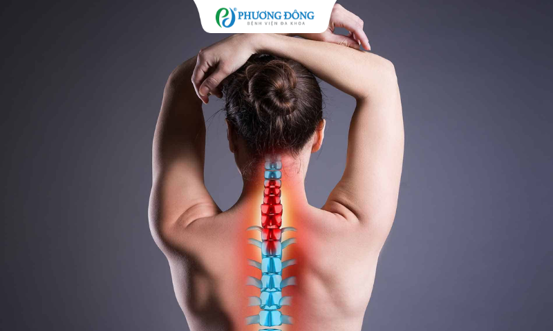 Có nên mổ thoát vị cột sống cổ không?