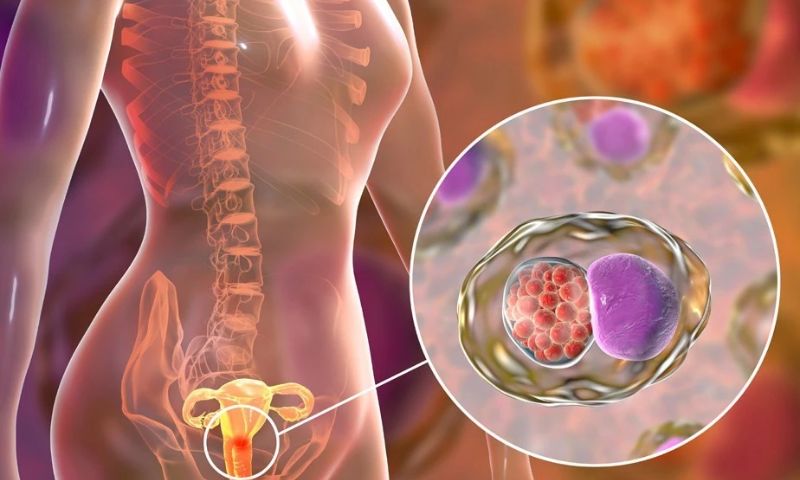Bác sĩ giải đáp: Ung thư cổ tử cung IIA có điều trị được không?