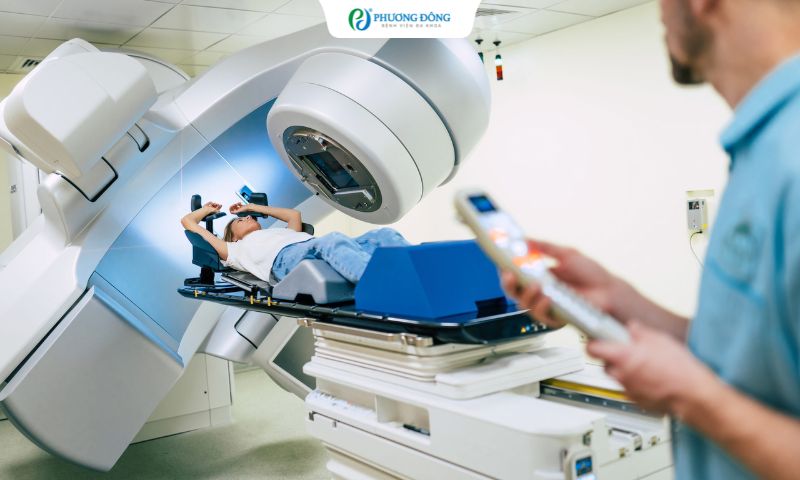 Bác sĩ Ung bướu giải đáp: Xạ trị ung thư hạch bao lâu thì có nguy cơ tái phát?