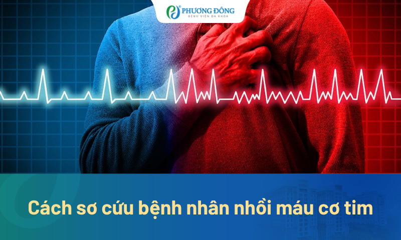 Cách sơ cứu bệnh nhân nhồi máu cơ tim: Việc nào cần làm, việc nào nên tránh?