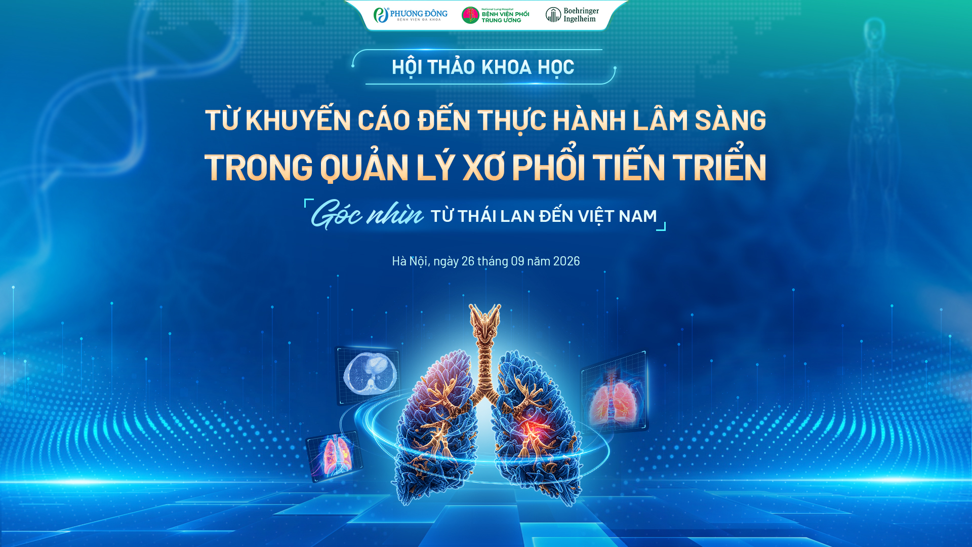 SẮP DIỄN RA HỘI THẢO KHOA HỌC VỀ XƠ HOÁ PHỔI TIẾN TRIỂN TẠI BỆNH VIỆN ĐA KHOA PHƯƠNG ĐÔNG 
