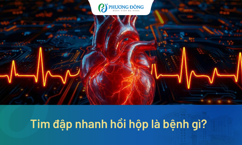 Tim đập nhanh hồi hộp là bệnh gì? Khi nào cần đi khám?