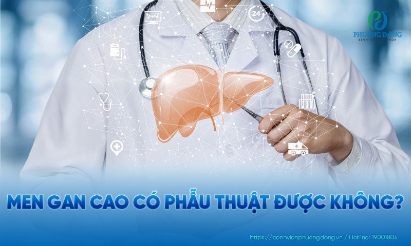 Men gan cao có phẫu thuật được không?