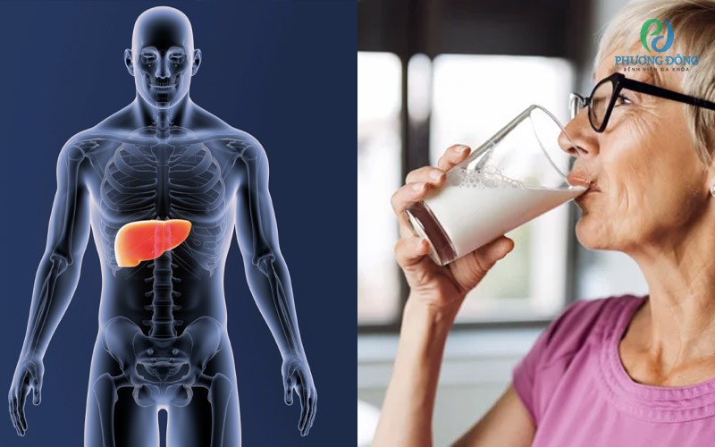 Việc lựa chọn loại sữa phù hợp với người men gan cao là vô cùng quan trọng
