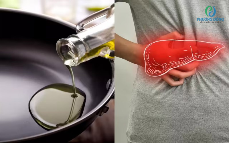 Chế độ ăn ít mỡ, giàu chất xơ và các dưỡng chất cần thiết sẽ giúp hỗ trợ quá trình điều trị và phục hồi chức năng gan hiệu quả hơn.