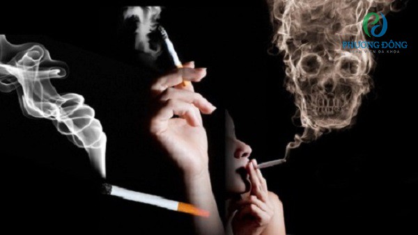 Khói thuốc lá là tác nhân chính gây ung thư phổi