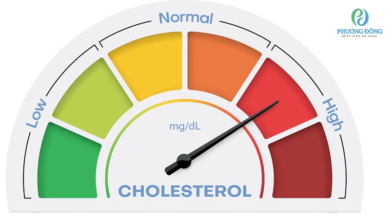Người có chỉ số cholesterol cao nên sử dụng gói khám tầm soát nguy cơ đột quỵ