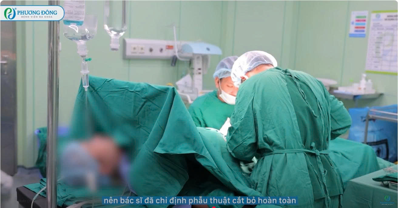 Phẫu thuật cắt bỏ khối nang kích thước khủng vùng bìu bẹn