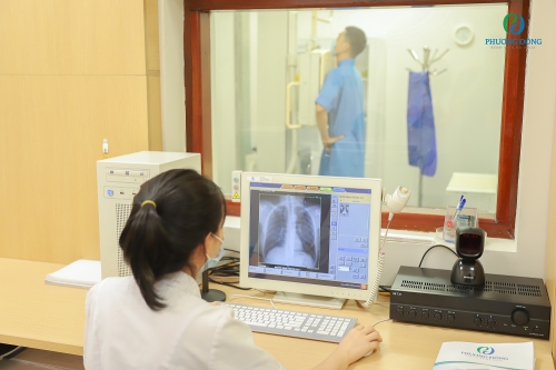 Bác sĩ quan sát hình ảnh thu được trong quá trình chụp Xquang tim phổi