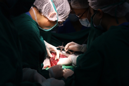 Bác sĩ bóc tách riêng phần khối u để loại bỏ