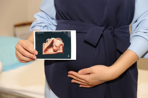 Hình ảnh thai nhi sau siêu âm