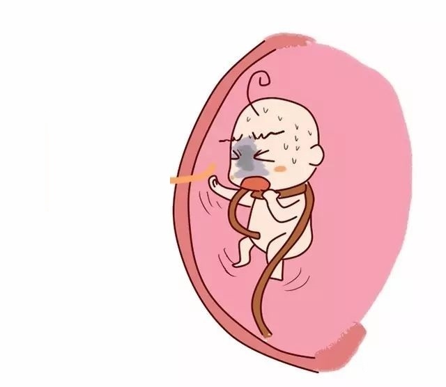 Dây rốn quấn cổ đấy khiến em bé không nhận đủ máu nuôi cũng là nguyên nhân thai ngừng phát triển