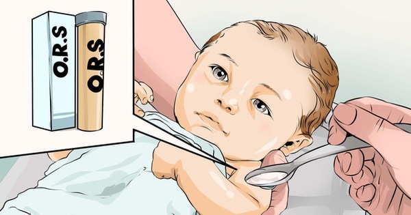 Cha mẹ cần lưu ý cho trẻ bị tiêu chảy cấp uống oresol đúng cách