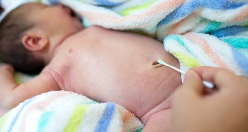 Cách vệ sinh rốn cho trẻ sơ sinh sau khi rụng - Ba mẹ nên biết