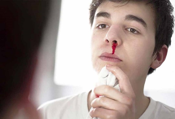 Chăm sóc và điều trị chảy máu mũi gây ra bởi stress có những phương pháp nào hiệu quả?
