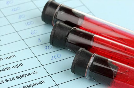 Biết rõ chỉ số MPV là gì sẽ giúp hiểu đúng về kết quả xét nghiệm máu