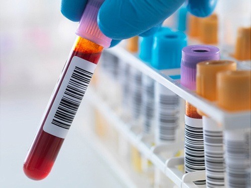 Khi nào cần kiểm tra chỉ số MPV trong máu?