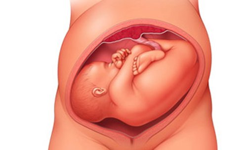Dấu hiệu chuyển dạ của ngôi thai ngược tương đối giống với ngôi thai thuận