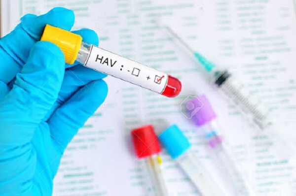 Xét nghiệm HAV giúp chẩn đoán bệnh viêm gan A