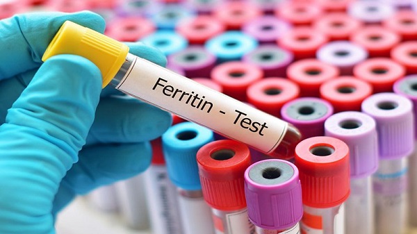 Chỉ số Ferritin tăng có thể là dấu hiệu cảnh báo các tổn thương tại gan