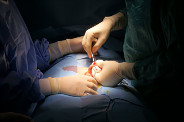 Bác sĩ bệnh viện Đa khoa Phương Đông đang làm thủ thuật cắt bao quy đầu