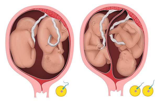 Ngôi thai ngược là gì? Dấu hiệu thai nhi quay đầu ngôi ngược