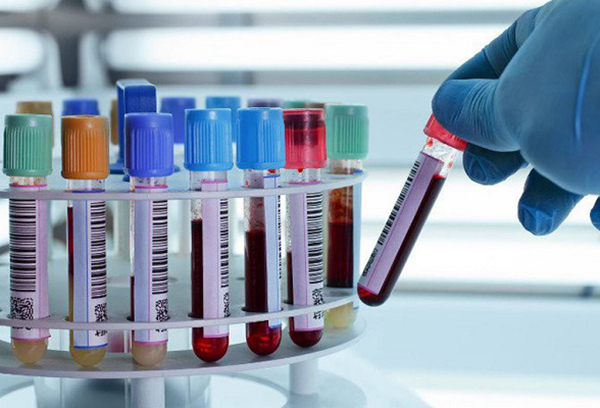 Đa số phương pháp xét nghiệm dị tật bẩm sinh thai nhi là xét nghiệm sinh hóa từ mẫu máu.