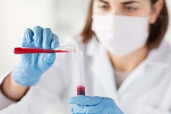 Làm sao để điều chỉnh chỉ số MCV trong xét nghiệm máu? 
