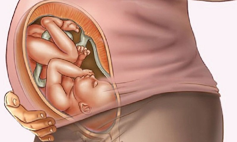 hình ảnh mô phỏng ngôi thai đầu 