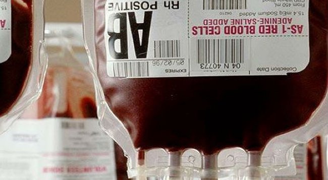 Người có nhóm máu AB cần lưu ý để bảo vệ sức khỏe