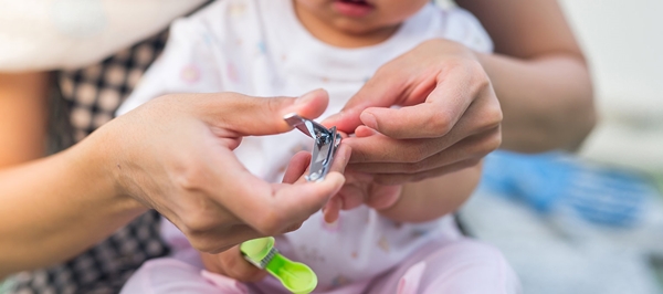 cắt móng tay của trẻ bị chốc để tránh tình trạng gãi khi ngứa