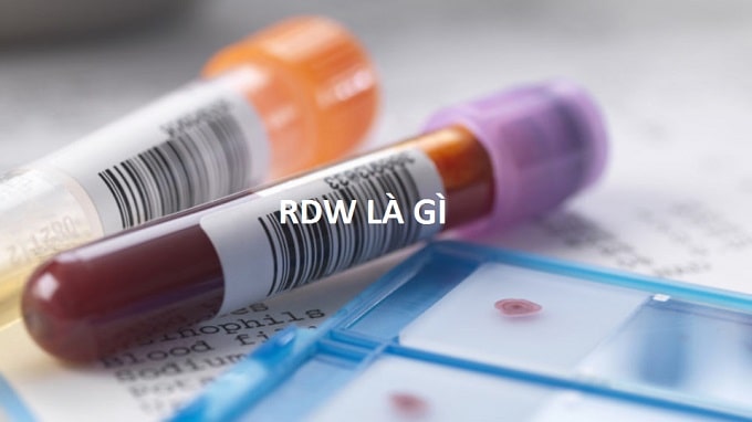 Làm thế nào để giảm bất thường về RDW-CV trong xét nghiệm máu?
