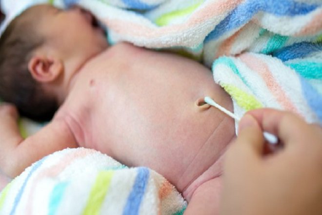 Những biến chứng nào có thể xảy ra khi rốn em bé sơ sinh bị chảy máu?
