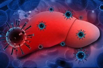 Bệnh viêm gan C: Nguyên nhân gây bệnh và cách điều trị