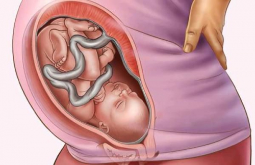 Dây rốn quấn cổ 1 vòng tuần 35: mẹ bầu cần làm gì để sinh con khỏe mạnh