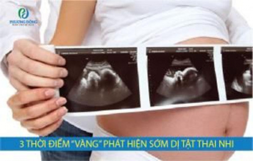 3 thời điểm “VÀNG” giúp phát hiện sớm dị tật thai nhi