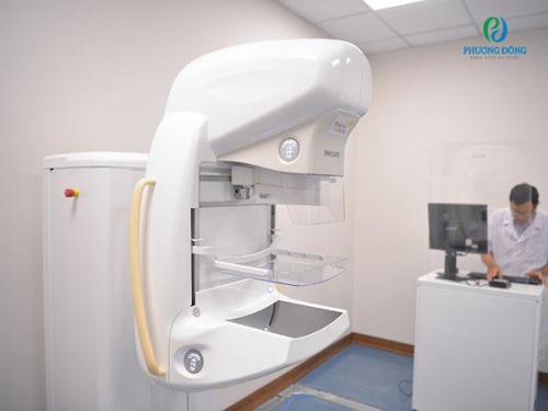 Chụp X-quang vú - Phương pháp sàng lọc phát hiện ung thư vú nhanh, chính xác