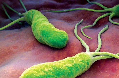 Vi khuẩn HP là gì? mức độ nguy hiểm của bệnh viêm loét dạ dày do khuẩn HP