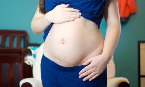 Sinh mổ 9 tháng có thai: Mẹ và bé đối mặt nhiều nguy cơ!