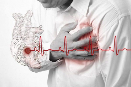 Thiếu máu cơ tim có nguy hiểm không? Một số lưu ý quan trọng