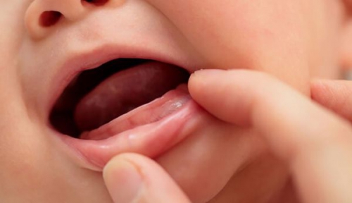 Trẻ 9 tháng chưa mọc răng có sao không?