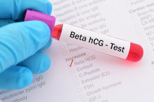 Xét nghiệm beta HCG có phải nhịn ăn không?