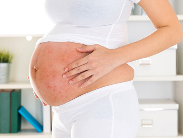 Phụ nữ có thai bị bệnh thủy đậu làm tăng nguy cơ sảy thai, sinh non