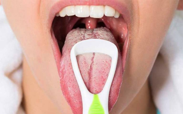 Có những nhóm người nào có nguy cơ cao mắc phải lưỡi trắng và đắng miệng?
