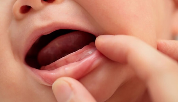 Trẻ 9 tháng chưa mọc răng có sao không phụ thuộc vào nhiều yếu tố