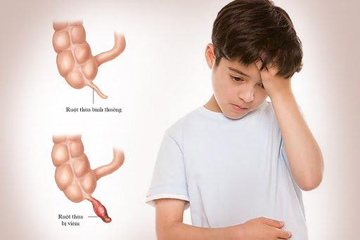 Có những dấu hiệu nào giúp phân biệt trẻ bị đau bụng từng cơn và sốt với các vấn đề sức khỏe khác?
